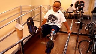 Prosthetist Makes Customized Artificial Limbs For Children Of All Economic Means [upl. by Neelrihs]