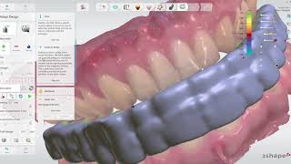 How to design and print an occlusal splint using 3Shape [upl. by Lavinia]