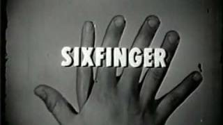 SIXFINGER TOY BY TOPPER [upl. by Lisk361]