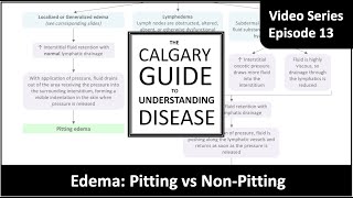 Edema Pitting vs Nonpitting [upl. by Narra455]