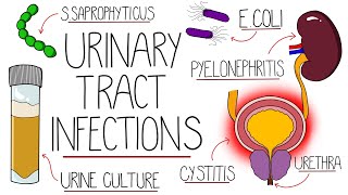 UTI Made Easy  Urinary Tract Infections Explained Clearly [upl. by Nauqaj485]