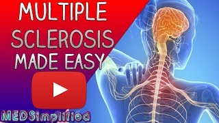 Multiple Sclerosis Made Easy PathophysiologysymptomsTreatment [upl. by Dwayne66]