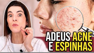 Elimine a ACNE e TODAS as ESPINHAS INFLAMADAS com essa Receita [upl. by Ardolino]