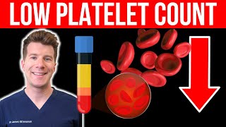 Doctor explains LOW PLATELET COUNT Thrombocytopenia  Causes symptoms and more [upl. by Ree]