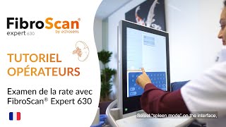 FibroScan® Expert 630  Tutoriel mesure de lélasticité de la rate [upl. by Sharity445]