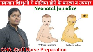 Physiological Neonatal jaundice with causes types amp treatment in hindi  level of bilirubin [upl. by Elleirua]