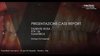 PROPHYLAXIS  CASE REPORT  Profilassi con scaling e airpolishing Dr Igor de Pasquale [upl. by Yoo]