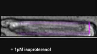 cardiac myocyte contractility [upl. by Magill]