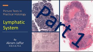 Atrial septal defect  Circulatory System and Disease  NCLEXRN  Khan Academy [upl. by Tuinenga]