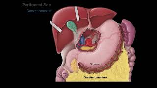 Peritoneum tutorial [upl. by Baruch]