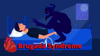 What is Brugada Syndrome ECG Symptoms Pathophysiology amp Treatments [upl. by Ellehcem854]