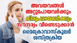 എന്താണ് മൈക്രോവാസ്കുലർ സർജറി   Microvascular Surgery Malayalam  Daily Malayalam Health Tips [upl. by Jorrie]