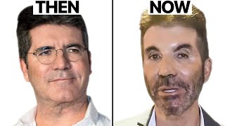 Simon Cowell NEW FACE  Plastic Surgery Analysis [upl. by Peih]