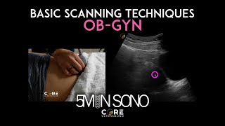 5 Minute Sono  Basic OBGyn Scanning Technique [upl. by Llevert]