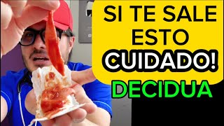 Endometriosis síntomas y tratamiento  Reacción Decidual Endometrial [upl. by Ultun]