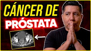 Mi PAPÁ tiene CÁNCER de PR0STAT4 ¿Cómo nos ENTERAMOS  Storytime  Mr Doctor [upl. by Lyj]