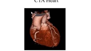 CT Thorax Procedures [upl. by Kenelm547]