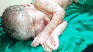 Cute and adorable newborn baby girl with vernix caseosa just born video 37weekspregnant babygirl [upl. by Fanchan]