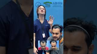 iPlus™️ FUE Hair Transplant  Happy patient with Good result  Klinik Dr Inder [upl. by Haonam]