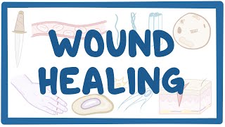 Wound healing [upl. by Novyat]