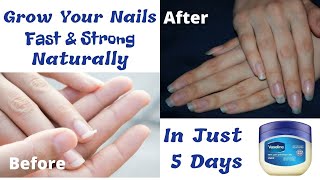 In just 5 Days Grow Long amp Strong Nails Fast At Home  Nail growth serum  My Nail Care Routine [upl. by Lipson792]