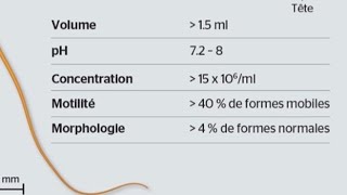 كيفية قراءة تحاليل السائل المنوي spermogramme [upl. by Rushing748]