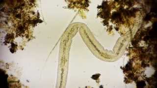 Nematoda  Fadenwurm  microorganism microcosmos under a microscope in Full HD 1080p [upl. by Lerner]