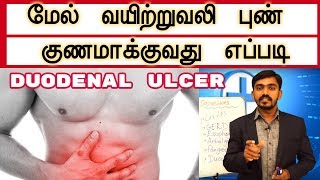 மேல் வயிற்றுவலி அல்லது முன்சிறுகுடல் புண் குணமாக்குவது எப்படி l Duodenal ulcer Cure Drsj [upl. by Theurer]