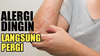 Obat alergi dingin paling ampuhalergi hilang total [upl. by Niatsirk]