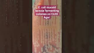 Ecoli Mucoid Lactose Fermenting Colonies on CLED Agar of Urine Culture [upl. by Moneta238]