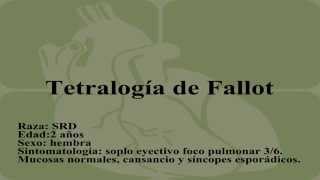 Tetralogía de Fallot [upl. by Cesya]