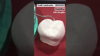 Landmarks on tooth surfaces  GROOVES PART 1 MAXILLARY 1st PREMOLAR  LINK IN DESCRIPTION Shortvideo [upl. by Roger]