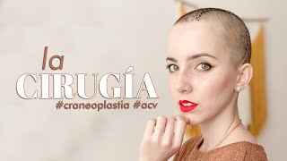 LA CIRUGIA craneoplastia acv [upl. by Maurili]