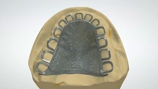 Cobalt Chrome plate strengthener for complete upper denture [upl. by Pomfret]