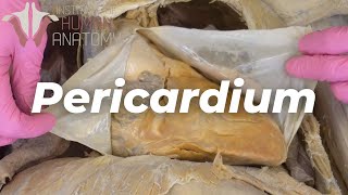 Your Heart Sits In a Sac  Pericardium amp Pericarditis [upl. by Annerahs]