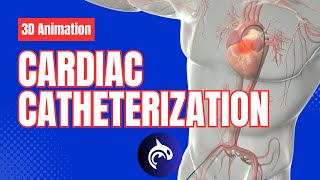 Cardiac Catheterization  3D Animation [upl. by Frum]