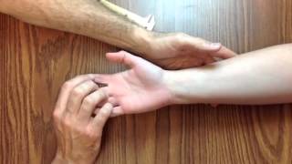 Hand Exam For Carpal Tunnel Syndrome [upl. by Hulen]