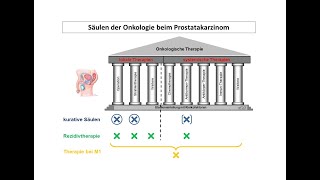 Säulen der Onkologie beim Prostatakarzinom  Strahlentherapie Prof Hilke Vorwerk [upl. by Rora]