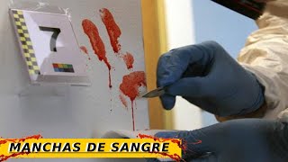 Clasificación de manchas de S4nGr3  Hematología Forense [upl. by Enaamuj819]