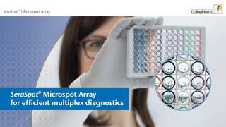 SeraSpot® – microspot array for efficient multiplex diagnostics [upl. by Cherye]