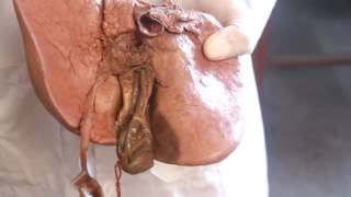 Anatomy  liver visceral impressionporta hepatis pouch of morrisons  Blood supply [upl. by Eclud]