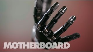 The MindControlled Bionic Arm With a Sense of Touch [upl. by Wales]