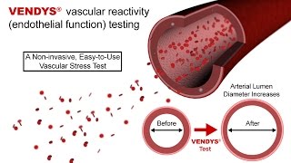 VENDYS  Endothelial Function Measurement Explained [upl. by Fred]