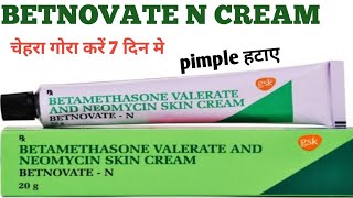 Betnovate N Cream  Betamethasone Valerate And Neomycin Skin Cream Review [upl. by Gunzburg]