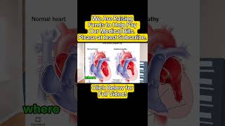 Cardiomyopathies one of Many Cardiovascular Diseases [upl. by Johann]