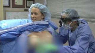 Mommy Makeover under local anesthesia by cosmetic surgeon Dr Walter W Tom [upl. by Diena]