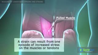 Lower Back Sprain and Strain Reasons [upl. by Eilyah]