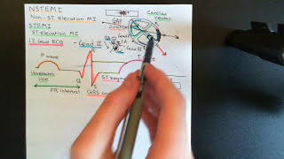 Coronary Artery Disease Part 8 [upl. by Stanfill]