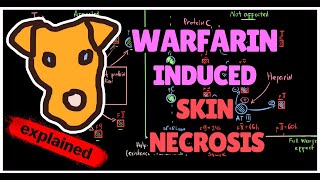 Pathogenesis of Warfarininduced skin necrosis Transient Hypercoagulation [upl. by Holds171]