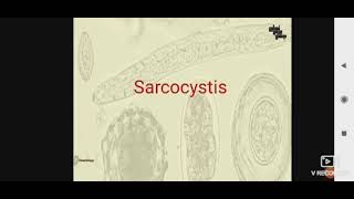 Sarcocystis para L3 [upl. by Goober]